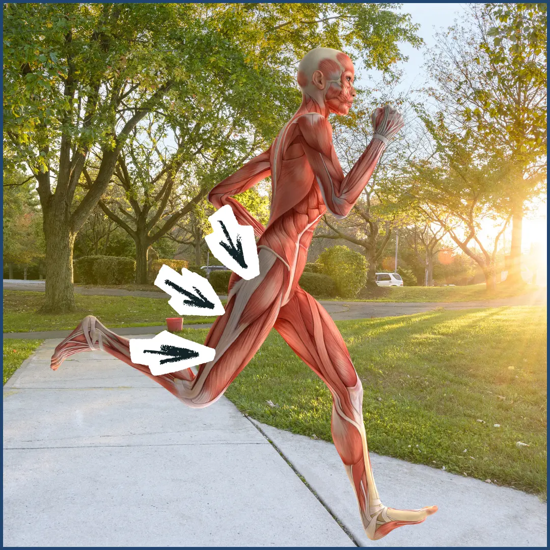 Plantar Fasciitis